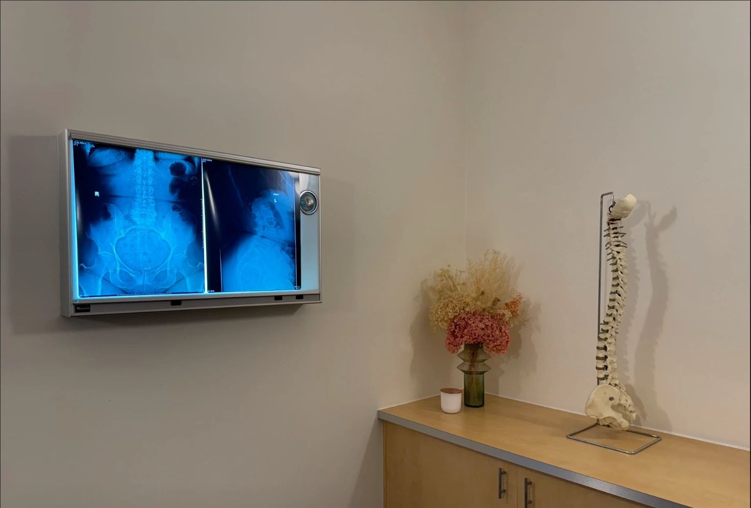 X-ray viewing screen and a spine model in a treatment room